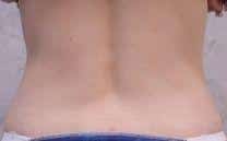 After Image