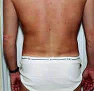 After Image
