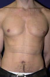After Image