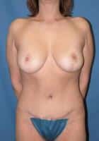 After Image