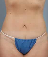 After Image