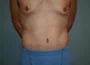 After Image