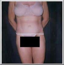 After Image