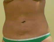 After Image