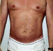 After Image