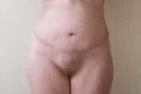 After Image