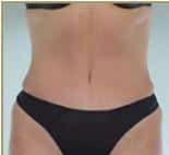After Image