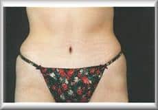 After Image