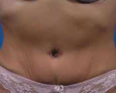 After Image