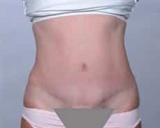 After Image