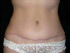 After Image