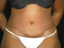 After Image