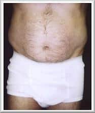 Before Image