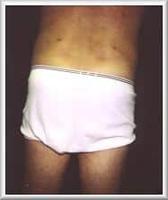 After Image