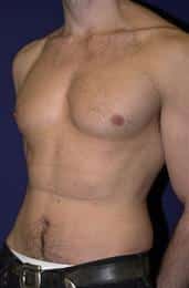 After Image