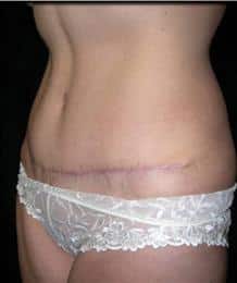 After Image