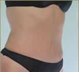 After Image
