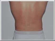 After Image