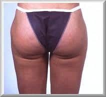 After Image