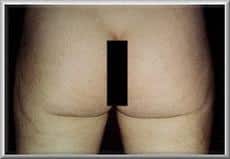 After Image
