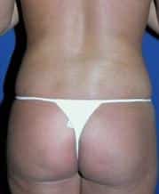 After Image