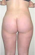 After Image