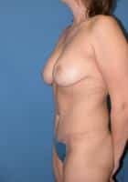 After Image