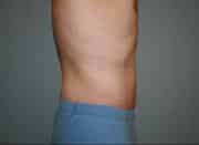 After Image