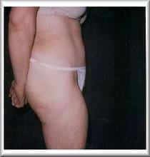 After Image