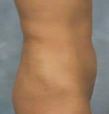 After Image