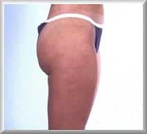 After Image