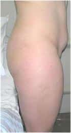 After Image