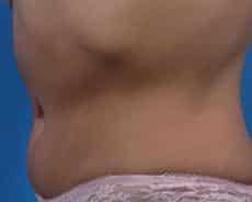 After Image
