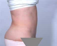 After Image
