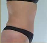After Image