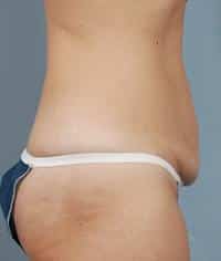 After Image