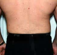 After Image