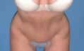 After Image