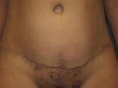 After Image