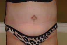 After Image