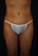 After Image