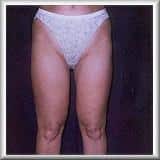 After Image