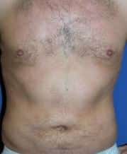 After Image