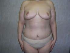 After Image