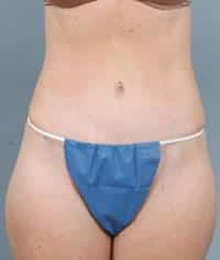After Image