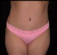 After Image