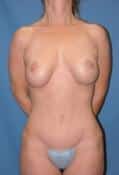 After Image