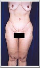 After Image
