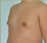 After Image