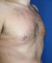 After Image